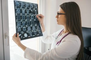 Female doctor looking at x-ray scan